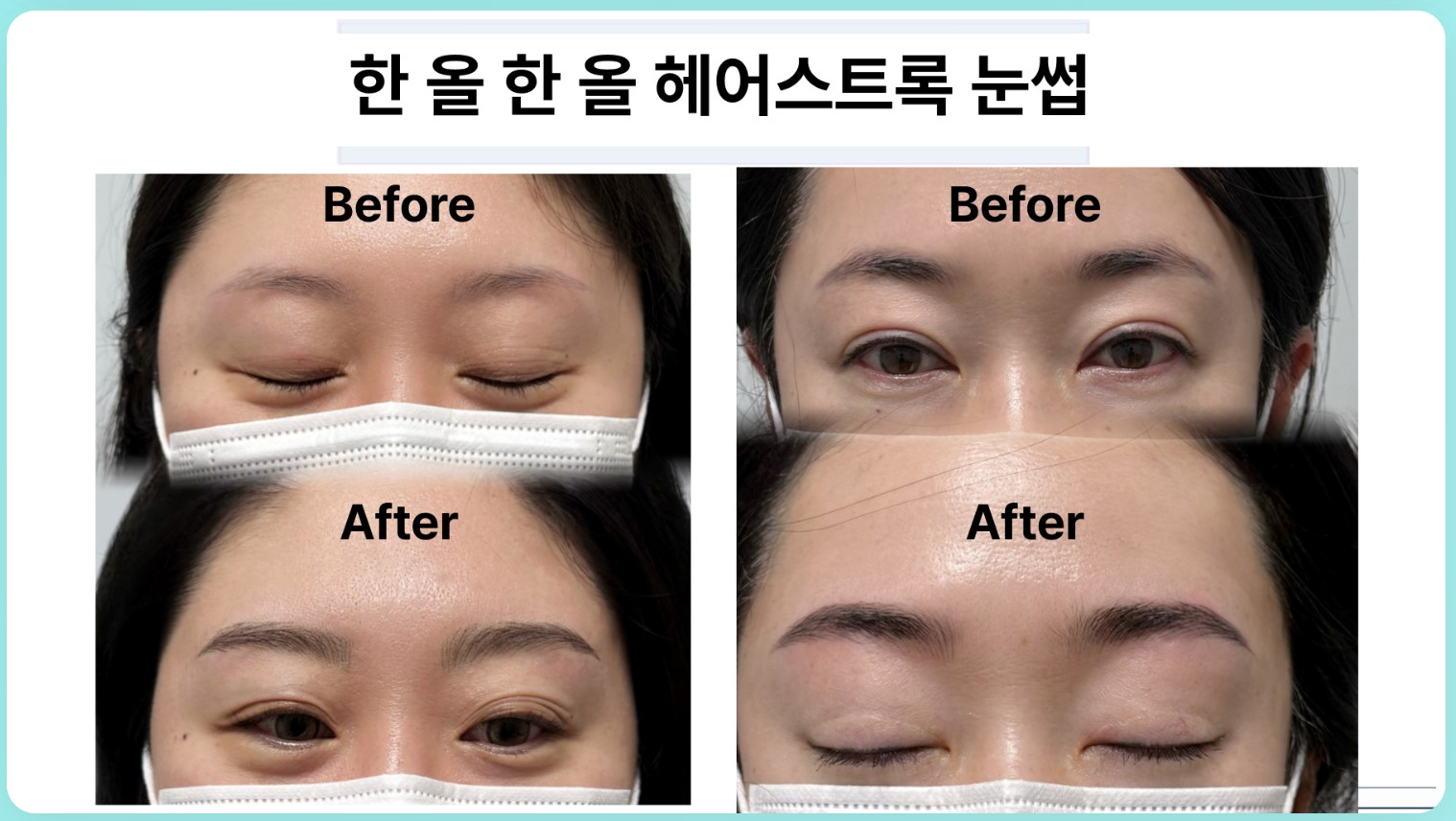 시술 사례 8